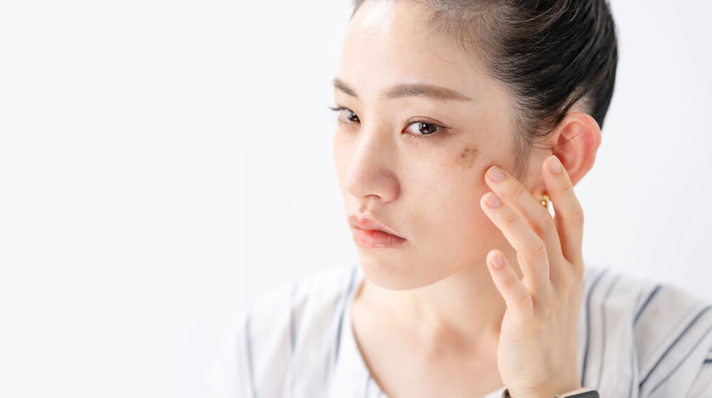 Pigmentation removal