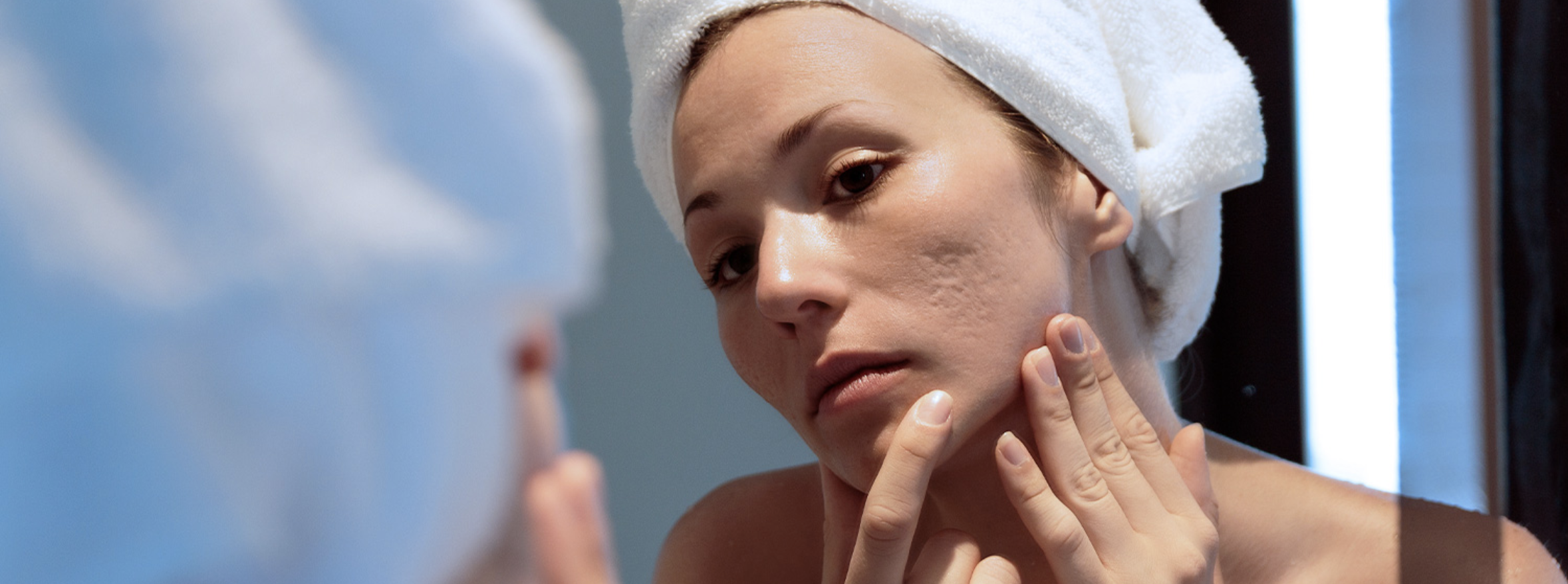 Subcision: Your Guide to Scar Removal & Skin Rejuvenation