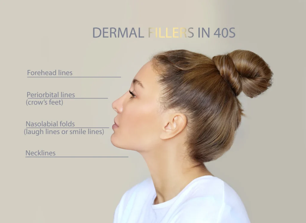 Dermal Fillers
