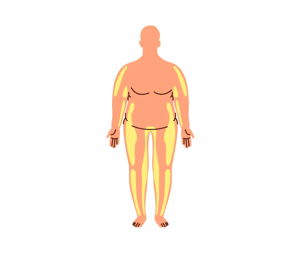 Lose Belly Fat Without Surgery
