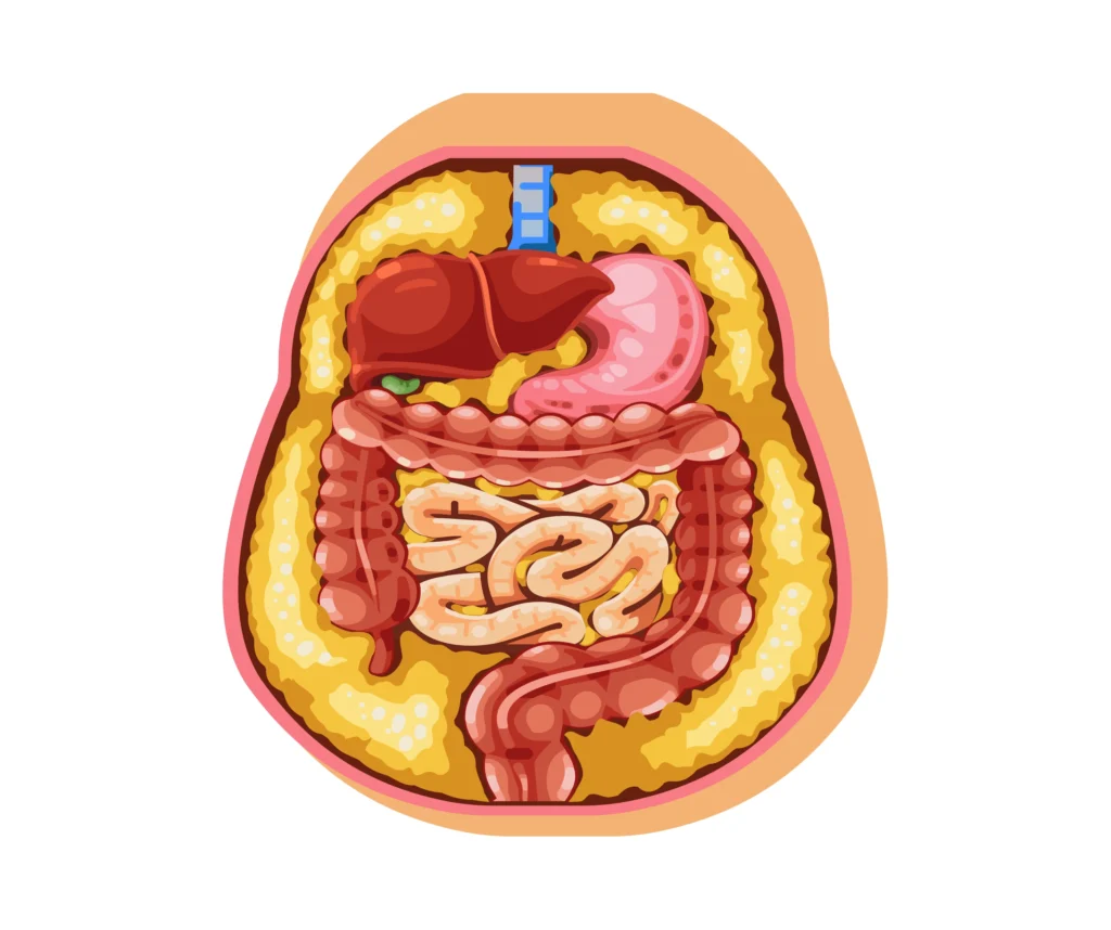 Lose Belly Fat Without Surgery