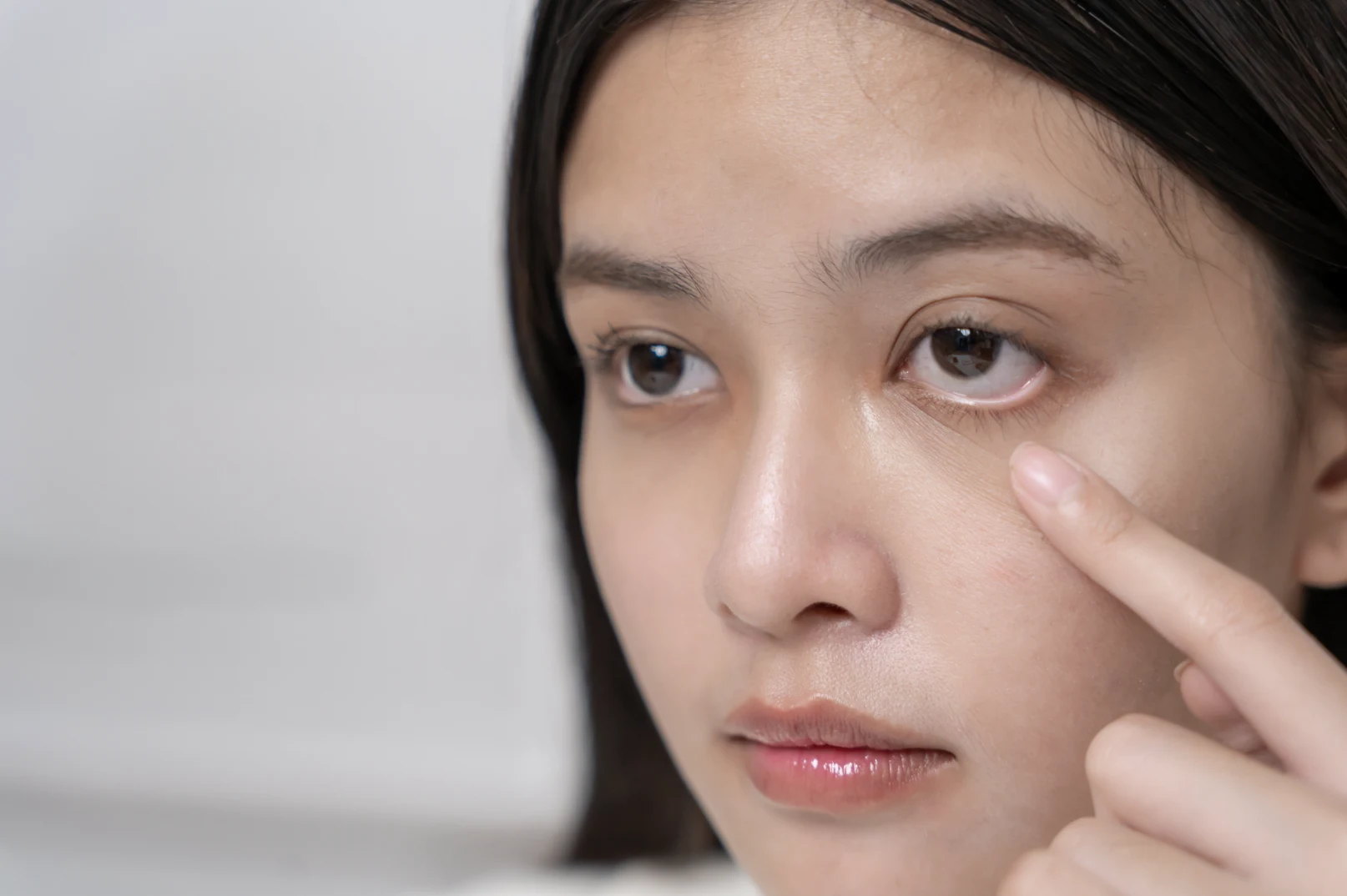 Under Eye Filler Singapore: Refresh Tired Eyes & Dark Circles
