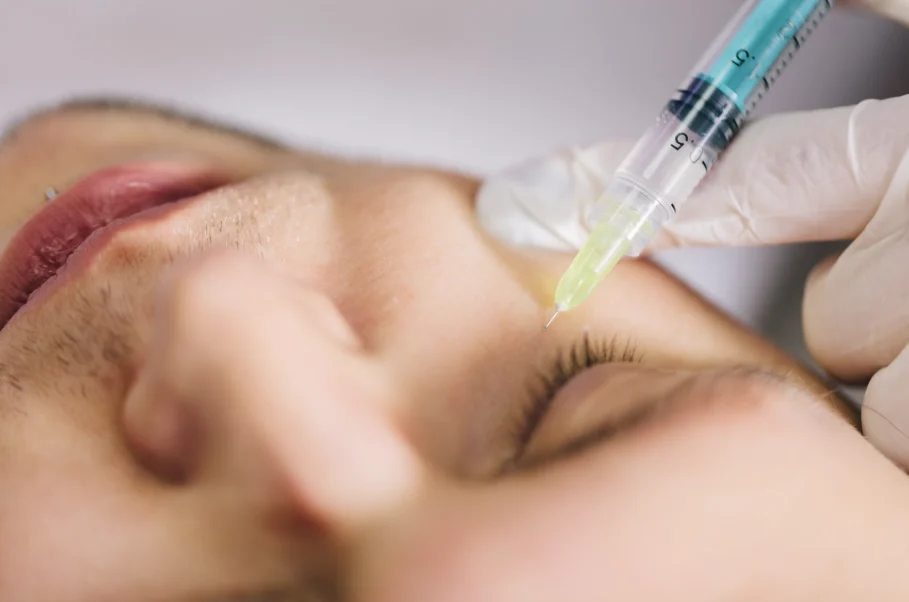 Close-up of a syringe injection under the eye, highlighting treatment longevity for How long does collagen stimulator last Singapore.